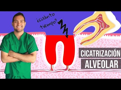 ALVEOLAR HEALING AFTER TOOTH EXTRACTION 👄 (2018) #30