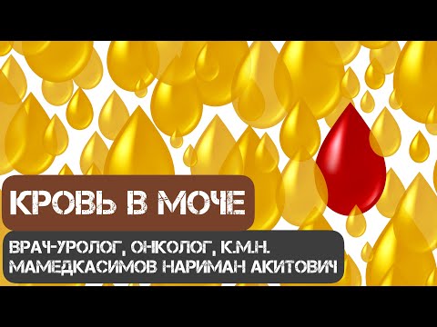 Кровь в моче! Что делать? Врач-уролог, онколог, к.м.н. Мамедкасимов Нариман Акитович