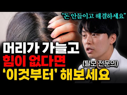 탈모 예방하는 방법 다 알려드립니다. 머리 숱이 풍성해지는 확실한 방법 '3가지' (김용빈 원장 통합본)