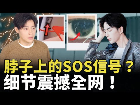 惊悚！于朦胧的“眼睛”揭开惊悚一幕？陈志朋隐晦指控什么？‘大佬’险成替罪羊, 艺人掀起脱离‘生死合约’浪潮？| Mr. 真知·论谈