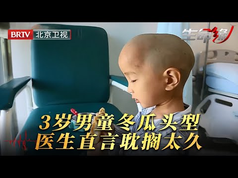 一出生头型像个冬瓜，家里人以为睡一睡就会恢复，直到3岁一次检查，医生的话像晴天霹雳……【生命缘第12季】
