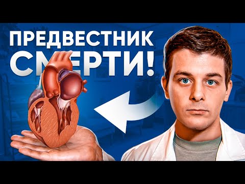 Гипертрофия левого желудочка сердца (ГЛЖ) | Что нужно знать!