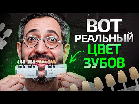 Какого цвета должны быть здоровые зубы? Ответ вас удивит