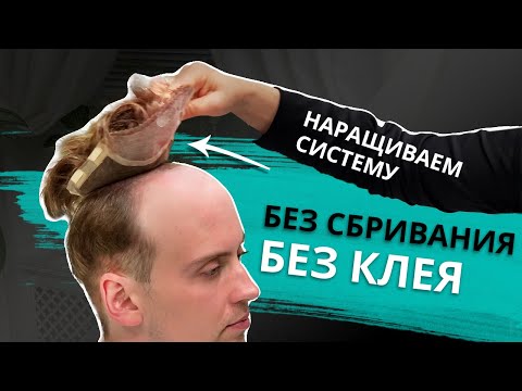 Мужская система волос без сбривания и без клея на коже.