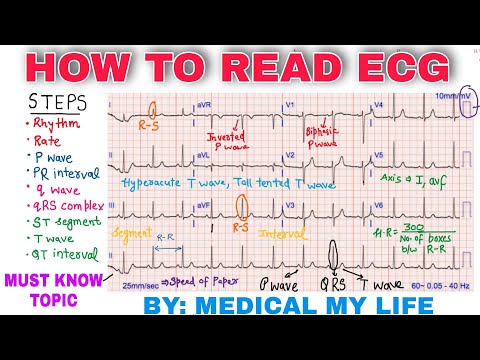 How To Read An ECG