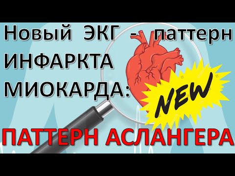ЭКГ при Инфарктах миокарда: Паттерн Аслангера (Aslanger's Pattern)