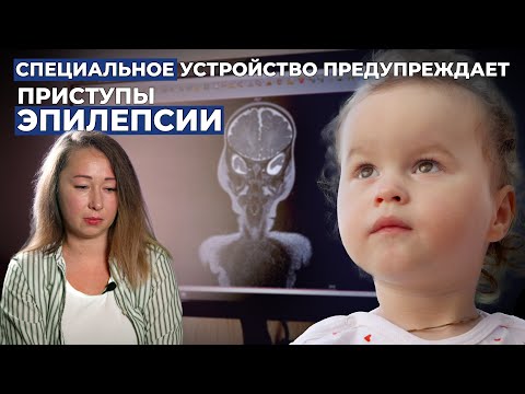 СТРУКТУРНАЯ ФОКАЛЬНАЯ ЭПИЛЕПСИЯ | История Николь Масловой