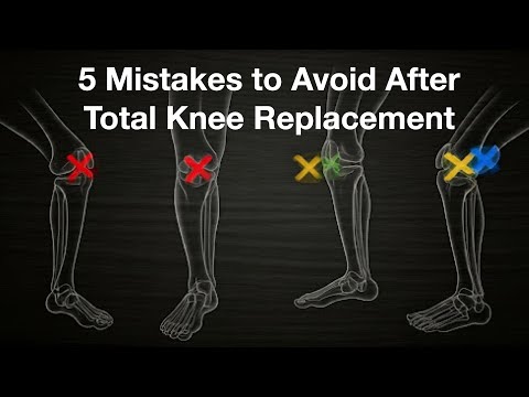 Don't Ruin Your Knee Replacement With These Common Errors