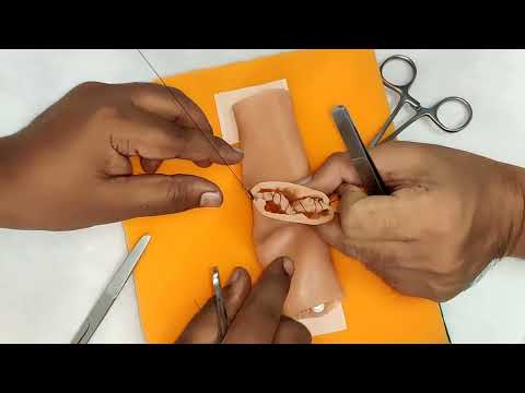 Simutomy- Learn End-to-End Bowel Anastomosis (Type-A) #BowelAnastomosis #InstestineSuturing
