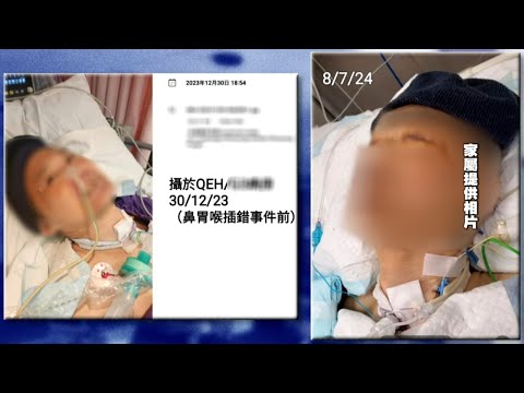 插錯胃喉入支氣管瀕死  院方認為ICU搬至加護病房對治療沒影響