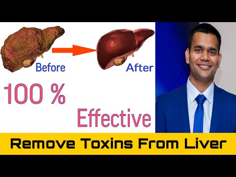 Liver Detox | Remove Toxins From your Liver | Dr. Vivek Joshi