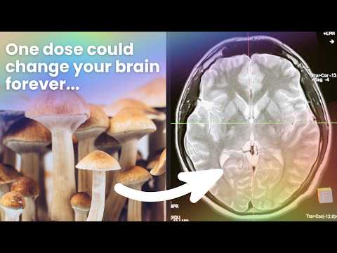 How Scientists Believe Psilocybin Rewires the Brain