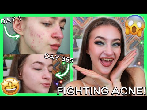 I'VE BEEN FIGHTING MY ACNE FOR 1 YEAR... AND I'VE WON!! (365 day recap!) #acne #acnetreatment #skin