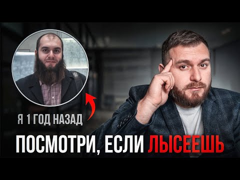 Что Делать, Если Начал ЛЫСЕТЬ? Спаси волосы...