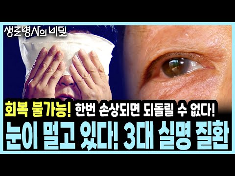 [눈 건강 경고] 한번 잃으면 끝! 소리 없이 다가와 실명시키는 '3대 안질환'의 치명적 경고! I KBS 20140924 방송