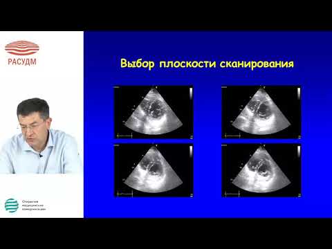 Эхокардиография в диагностике и ведении пороков митрального клапана сердца