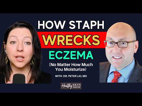 Staph Infection WRECKS Your Skin Barrier (Here’s Why You’re Having an Eczema Flare) | Peter Lio