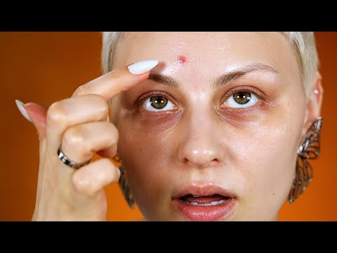 EVERY step to make these disappear, from start to FINISH