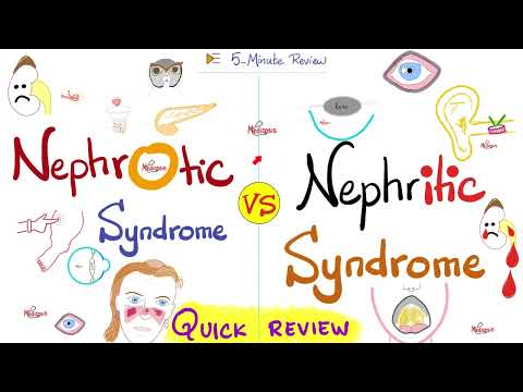 Nephrotic AND Nephritic Syndrome - Quick Review - Nephrology & Pathology