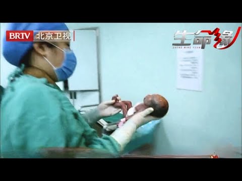 结婚6年终于怀孕，谁料第7个月被迫生产，孩子一出生震惊医生，皮肤半透明只有巴掌大……【生命缘第2季】