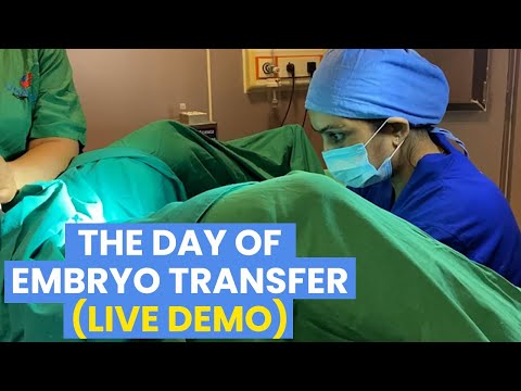 The Day of Embryo Transfer  (Live Demo) - Dr Asha Gavade Umang Hospital