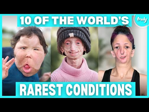 10 Incredible People Who Defied The Rarest Conditions | BORN DIFFERENT