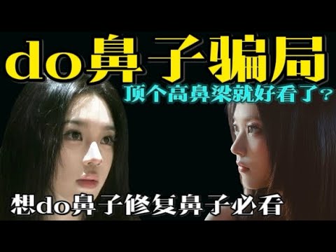 面部一枝花，全靠鼻当家，十鼻九修的原因终于找到了…