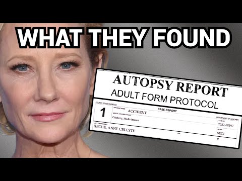 The REAL Story Behind Anne Heche's Fatal Crash
