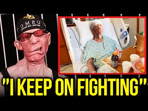 What Really Happened To Yellowman?