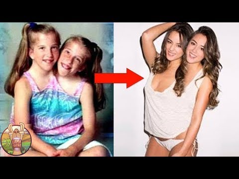10 FRÈRES ET SOEURS SIAMOIS QUI EXISTENT DANS LE MONDE | Lama Faché