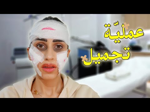 عملت اول عملية تجميل ل وجهي 😭 اقوى مقلب ب ماما 😱!