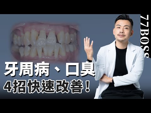 牙周病、口臭不要輕忽,4招快速改善,讓你轉身變成香嘴寶寶!!【77老大】