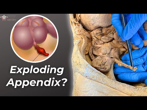 We Found Out What Your Appendix Is Really For