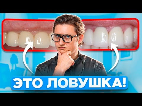 МЕТАЛЛОКЕРАМИКА или ЦИРКОНИЙ? Какие коронки выбрать в 2025 году?