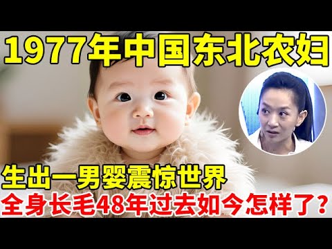 1977年,中国东北农妇生出一男婴震惊世界,全身长满毛,48年过去如今的他怎样了【王芳王为念访谈】#于震寰