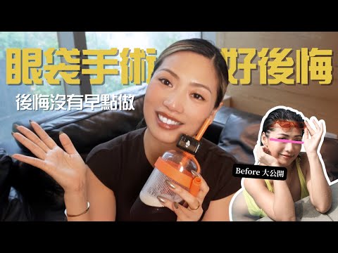 眼袋手術大公開！珍貴康復片段+三年後update！#女人像鹽 ｜Bonnie Man