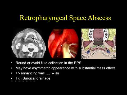 Suresh Mukherji  Emergency Head & Neck Radiology