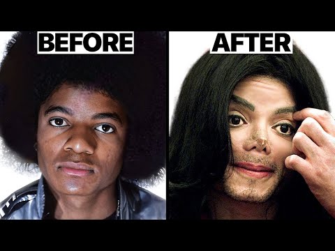 Michael Jackson Nose Job Plastic Surgeries - Surgeon Reacts
