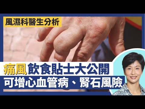 痛風症分4個階段可致痛風石關節變形 尿酸高延遲治療增心血管病、中風、腎石風險！高嘌呤食物致尿酸積聚 痛風飲食貼士大公開！女性荷爾蒙防痛風 男士風險高3倍｜王建芳醫生 風濕科王德龍醫生｜人類健康研究所