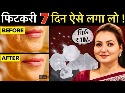 10 रूपए की चीज़ से Skin की सारी मुश्किल आसान - Facial Hair झाइयाँ Hyperpigmentation Wrinkles & More💕
