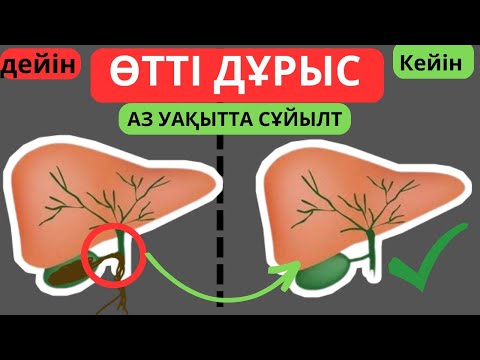 Егер өтіңді сұйылтқың келсе осы дәрі дәрмекпен шөптерді қолдан / Өтті сұйылту