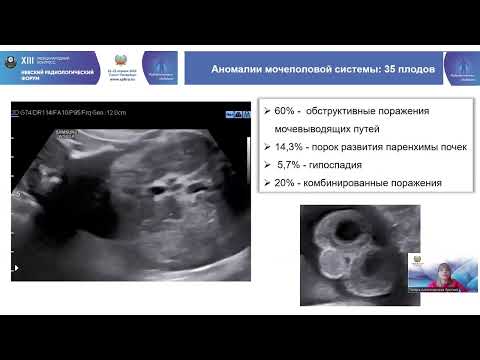 НАУЧНАЯ СЕКЦИЯ ПО ТЕЗИСАМ «УЗД +ЛД В ПЕДИАТРИИ»
