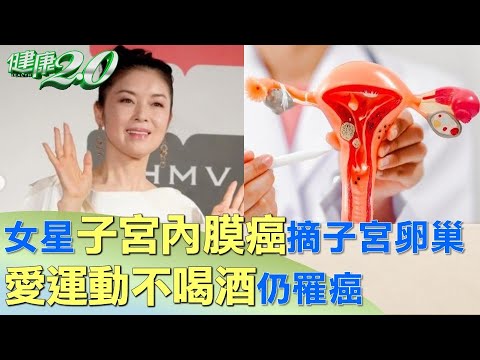 女星子宮內膜癌摘子宮卵巢 愛運動不喝酒仍罹癌 健康2.0 @tvbshealth20