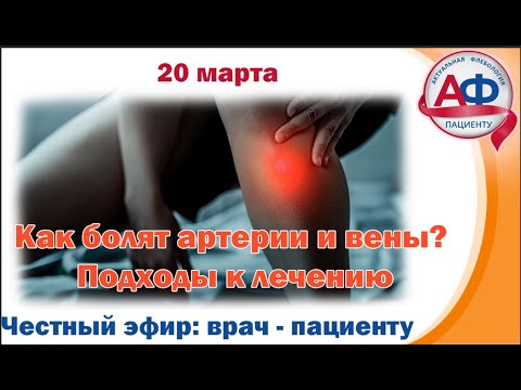 How Arteries and Veins Pain: Treatment Approaches