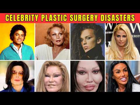 40 Celebrity Plastic Surgery Disasters | Before and After