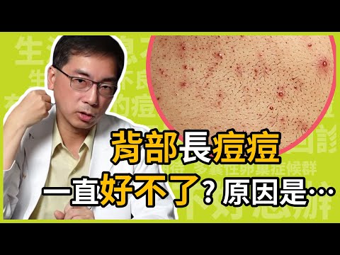 為什麼背部長痘痘，會一直治不好？怎麼治療才不會色素沉澱？治療背部痘痘的關鍵原因，醫美里長一次告訴你！