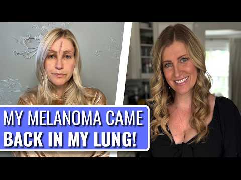 Stage 4 Melanoma Took One Of My Lungs! - Jennifer | Stage 4 Melanoma | The Patient Story