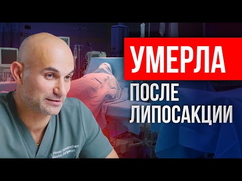 САМАЯ опасная операция | КАЖДАЯ женщина должна знать ЭТО