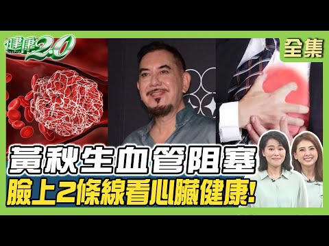 黃秋生血管阻塞 醫警告1年後會死！膽固醇過高恐中風、心梗 臉上2條線看心臟健康！ 健康2.0 20240824【完整版】陳欣湄 韋汝 林昌琦 柳朋馳 洪素卿 郭大維 潘瑋翔@tvbshealth20