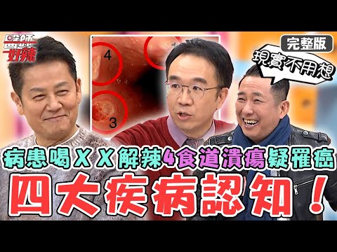 4大錯誤疾病認知！年輕病患「4食道潰瘍」環狀排列疑罹癌！全因半夜喝ＸＸ解辣釀禍？【#醫師好辣】20250222 完整版 症狀改善方式 EP1708 屈中恆 李佳豫